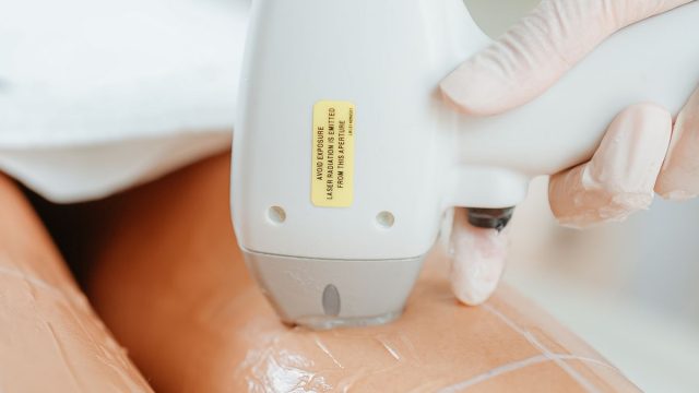 脱毛施術のイメージ