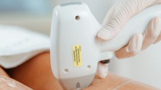 脱毛施術のイメージ