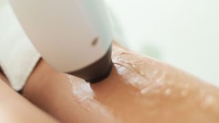 脱毛施術のイメージ