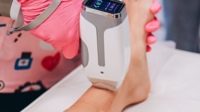 脱毛施術のイメージ