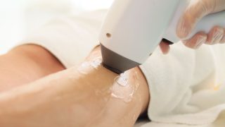 脱毛施術のイメージ