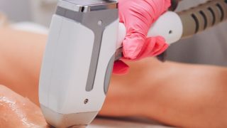 脱毛施術のイメージ