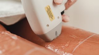 脱毛施術のイメージ