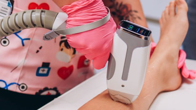 脱毛施術のイメージ